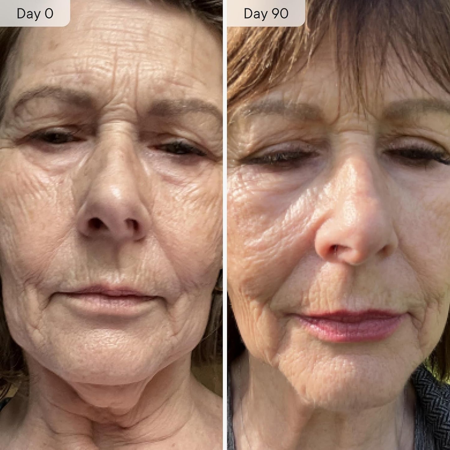 Qure Micro Infusion System for Face & Neck - Facial Moisturizing Essence, Hydrating Serum for All Skin Types, Refreshed Skin - 5-Month Supply