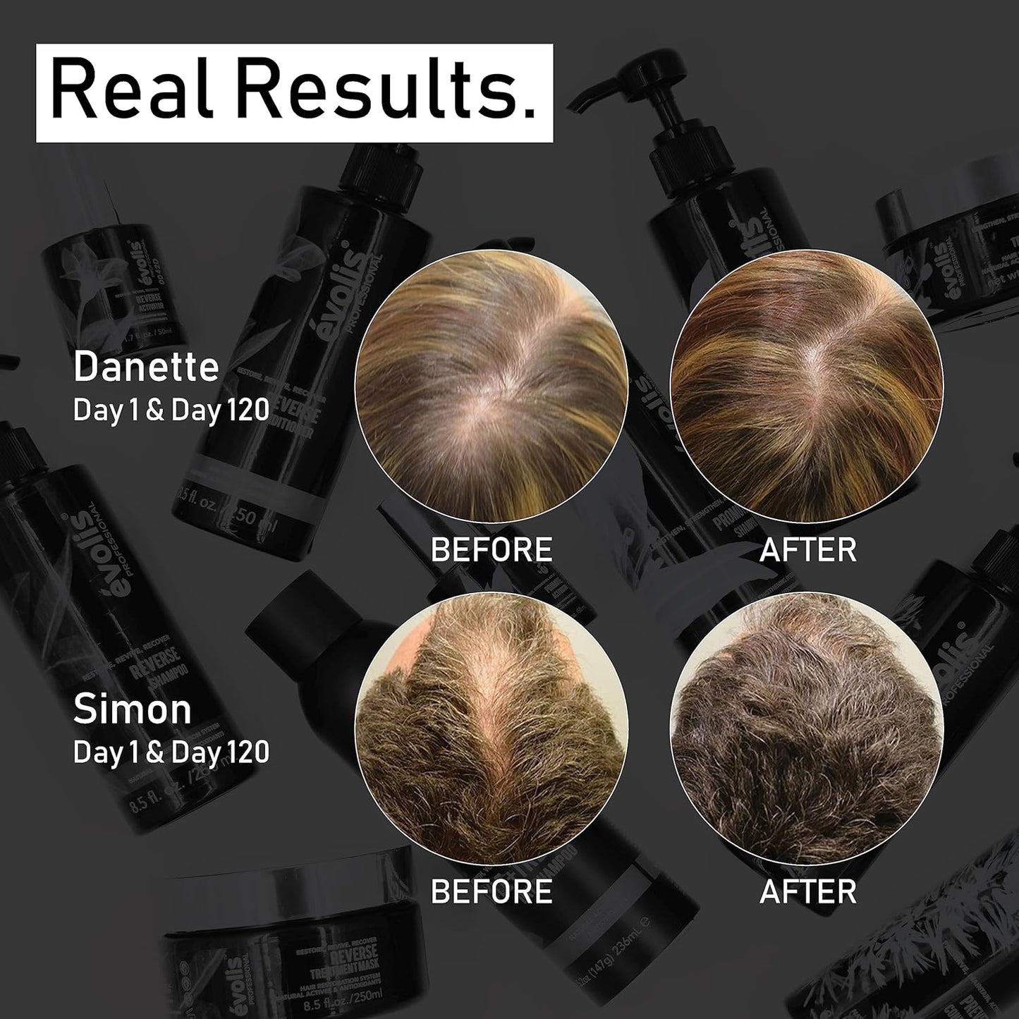 EVOLIS Promote Nourishing Treatment Mask - Deep Conditioning Hair Mask to Support Hair Growth - Hydrating Hair Mask for Dry, Damaged Hair (8 fl oz)