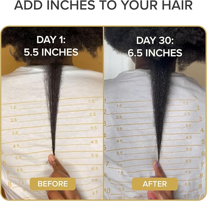 Iconic Natural Hair Vitamins for Fast Hair Growth - Pure Hair Supplements Formulated with Vitamins to Promote Thicker, Stronger Hair - Vegan Hair Care for Hair Loss - Non-GMO (60 Capsules)