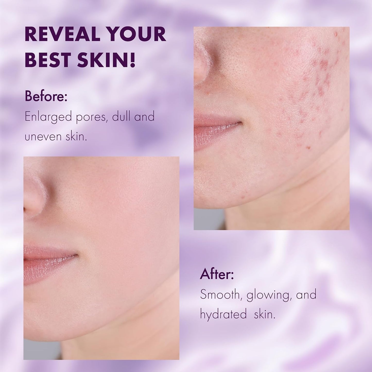 DERMAdoctor Ain't Misbehavin' Dermatologist Formulated Clarifying and Hydrating Toner with Glycolic Acid & Lactic Acid; For Oily and Acne Prone Skin, Pore Minimizer for Face and Body - 6 fl oz