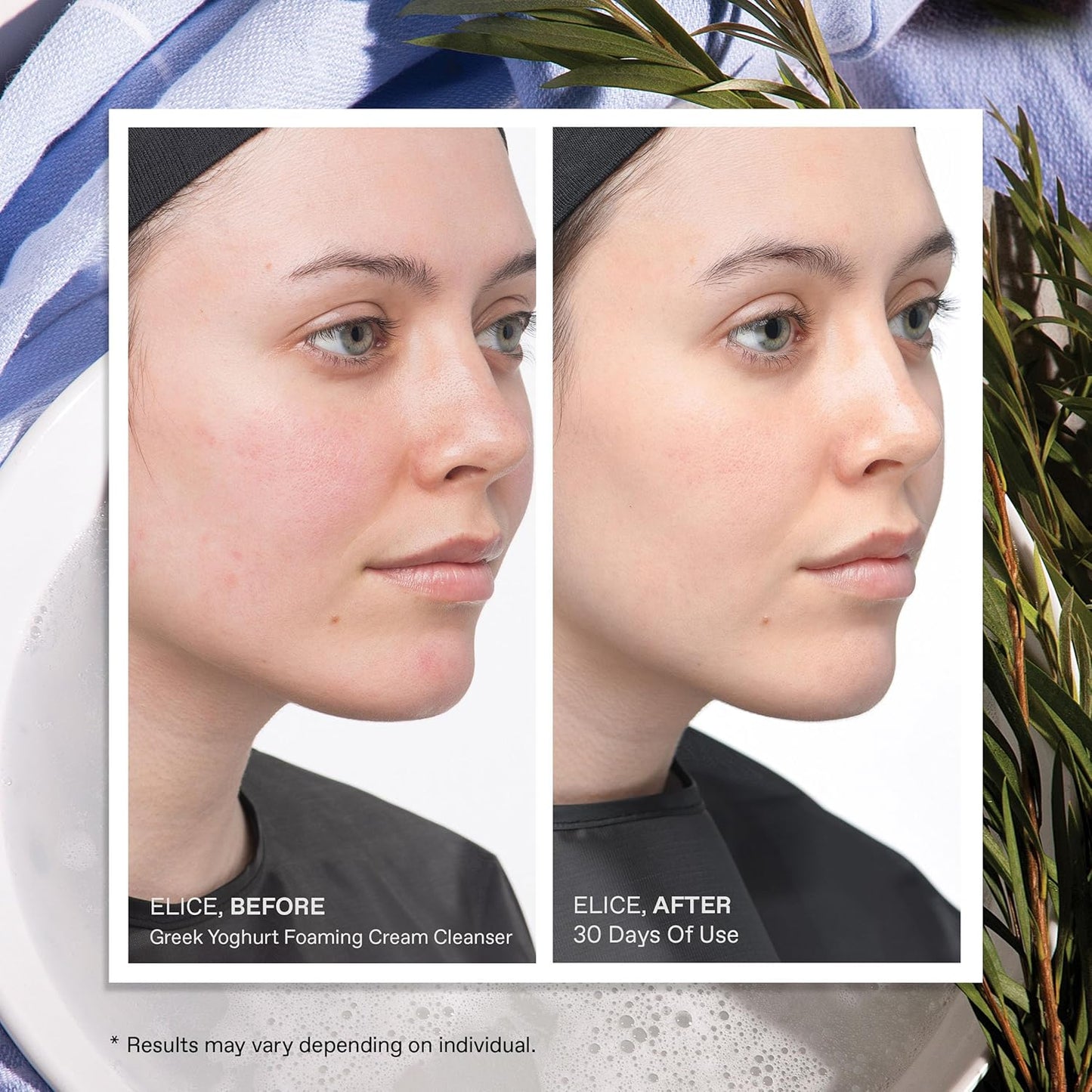 KORRES Greek Yoghurt Foaming Cream Cleanser, Hydrating, Deep Cleansing Skin Care, Makeup Remover, Face Wash for Women, Cream to Foam Facial Cleanser for Dry, Oily, Sensitive, Any Skin Type, 5.07 fl oz