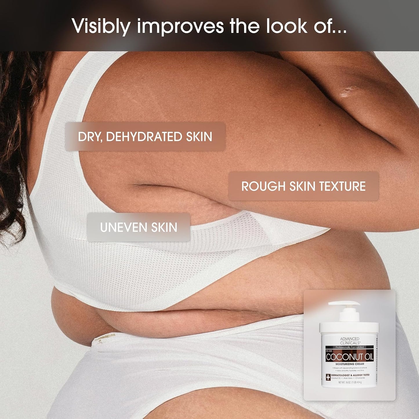 Advanced Clinicals Coconut Oil Body Cream For Women & Men | Hydrating Coconut Lotion For Extremely Dry Skin | Visible Anti Aging Body Butter Skin Care Balm Moisturizer For Hand, Heel, Feet, 16 Ounce