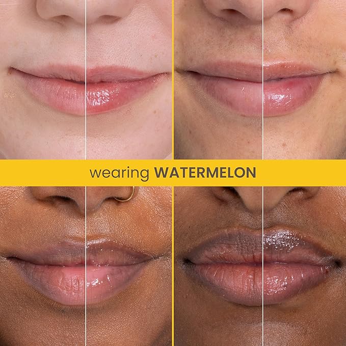 Burt's Bees Rescue Lip Relief, Watermelon, Hydrating Lip Balm for Dry Cracked Lips, with Responsbily Sourced Beeswax and Shea Butter, 100% Natural Origin, 1 Squeezy Tube, 0.35oz